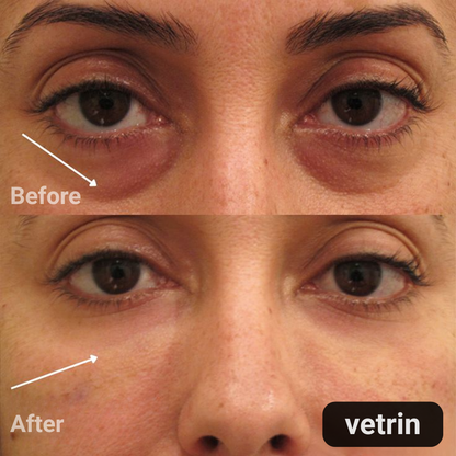 Lutein Eye Essence Oil