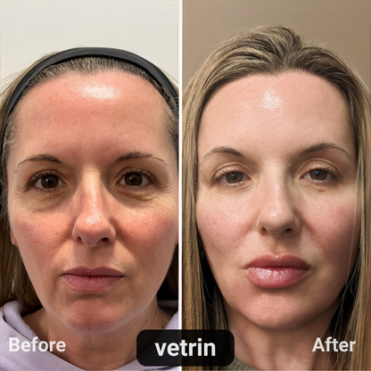 Lutein Eye Essence Oil